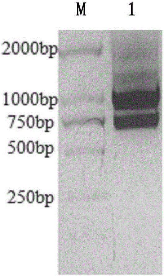 Nanobody resisting CEA (carcinoembryonic antigen) and application of nanobody