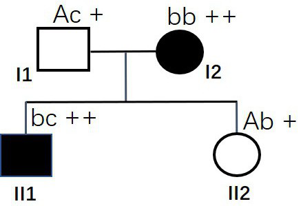 MSH6 gene with mutated 12907th site, and application of MSH6 gene