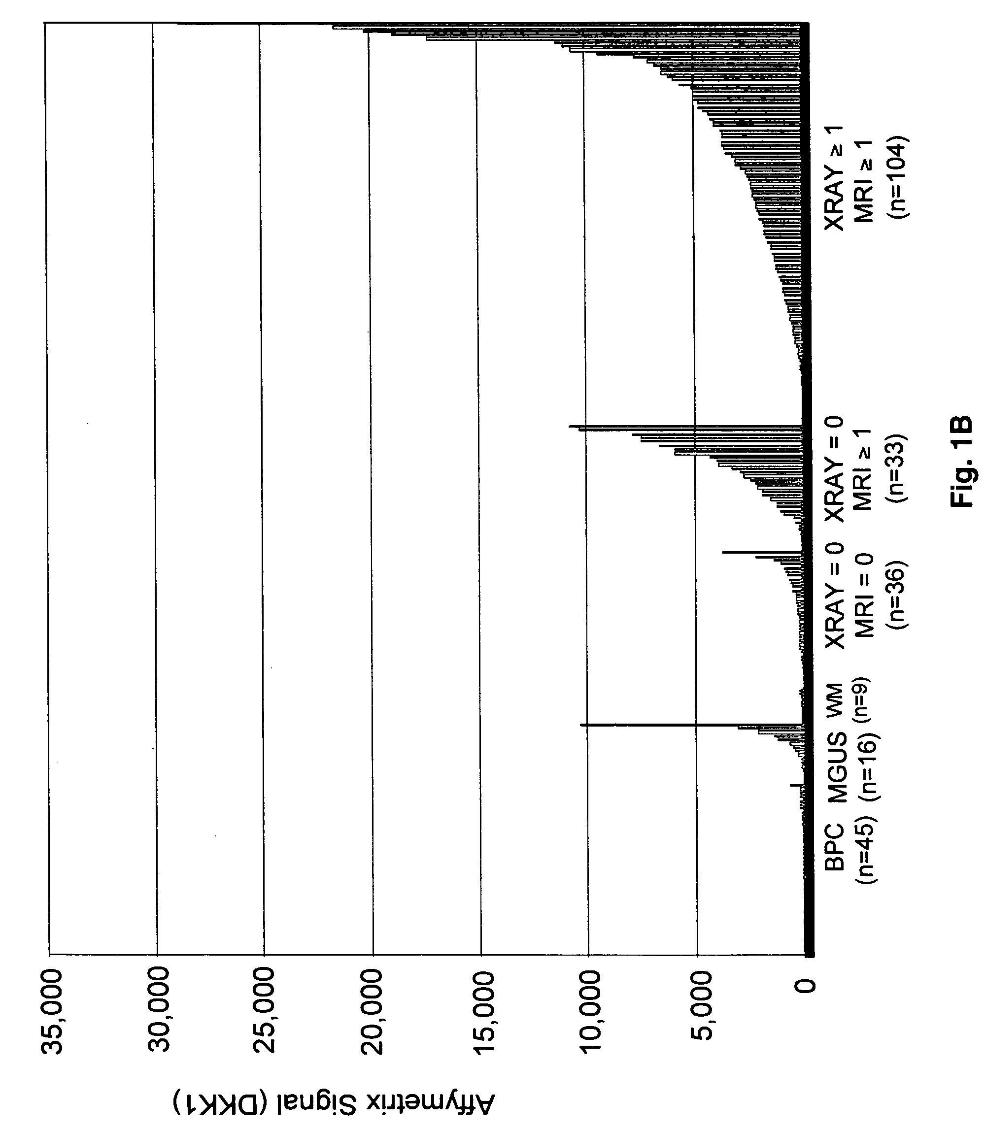 Molecular determinants of myeloma bone disease and uses thereof