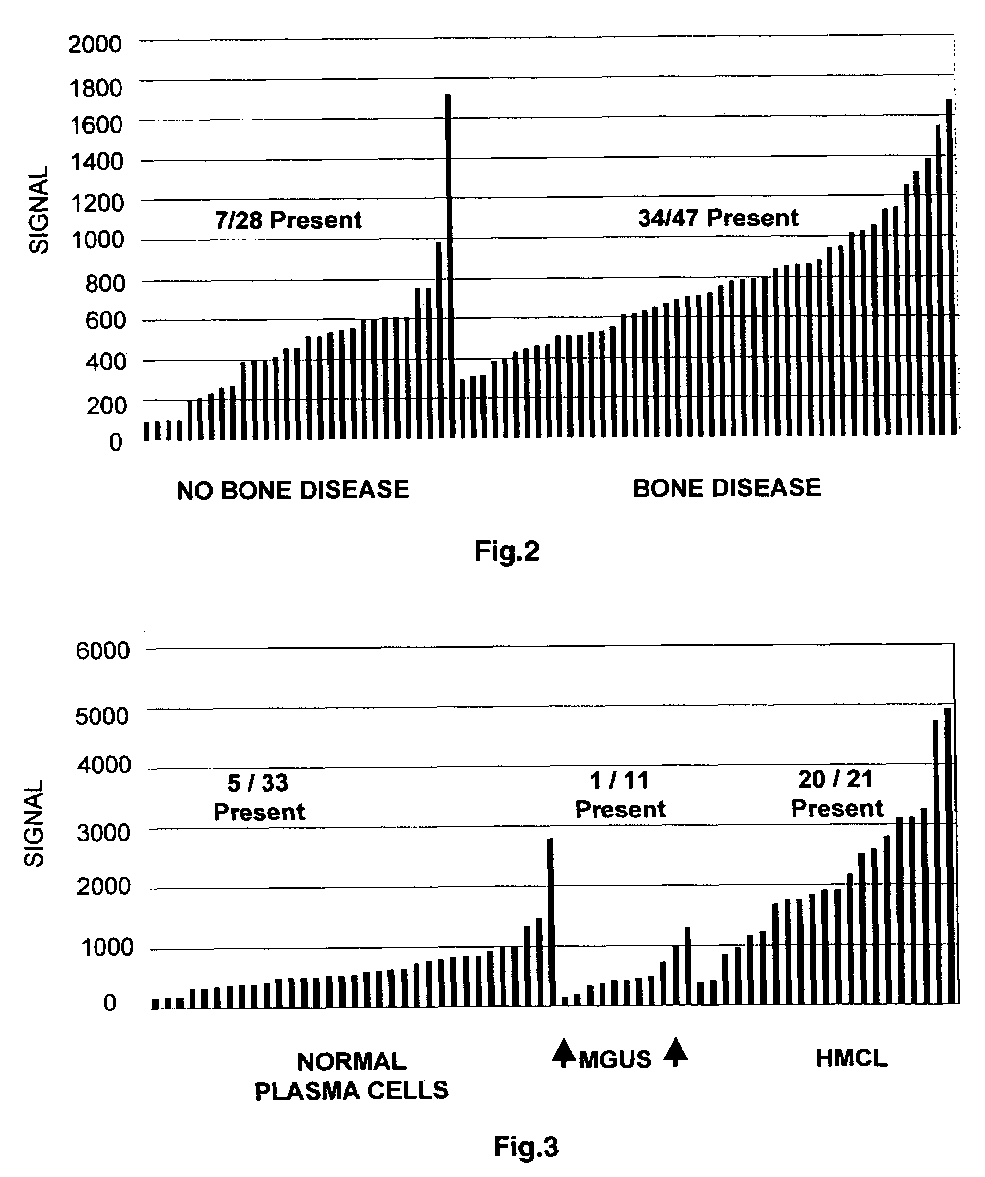 Molecular determinants of myeloma bone disease and uses thereof