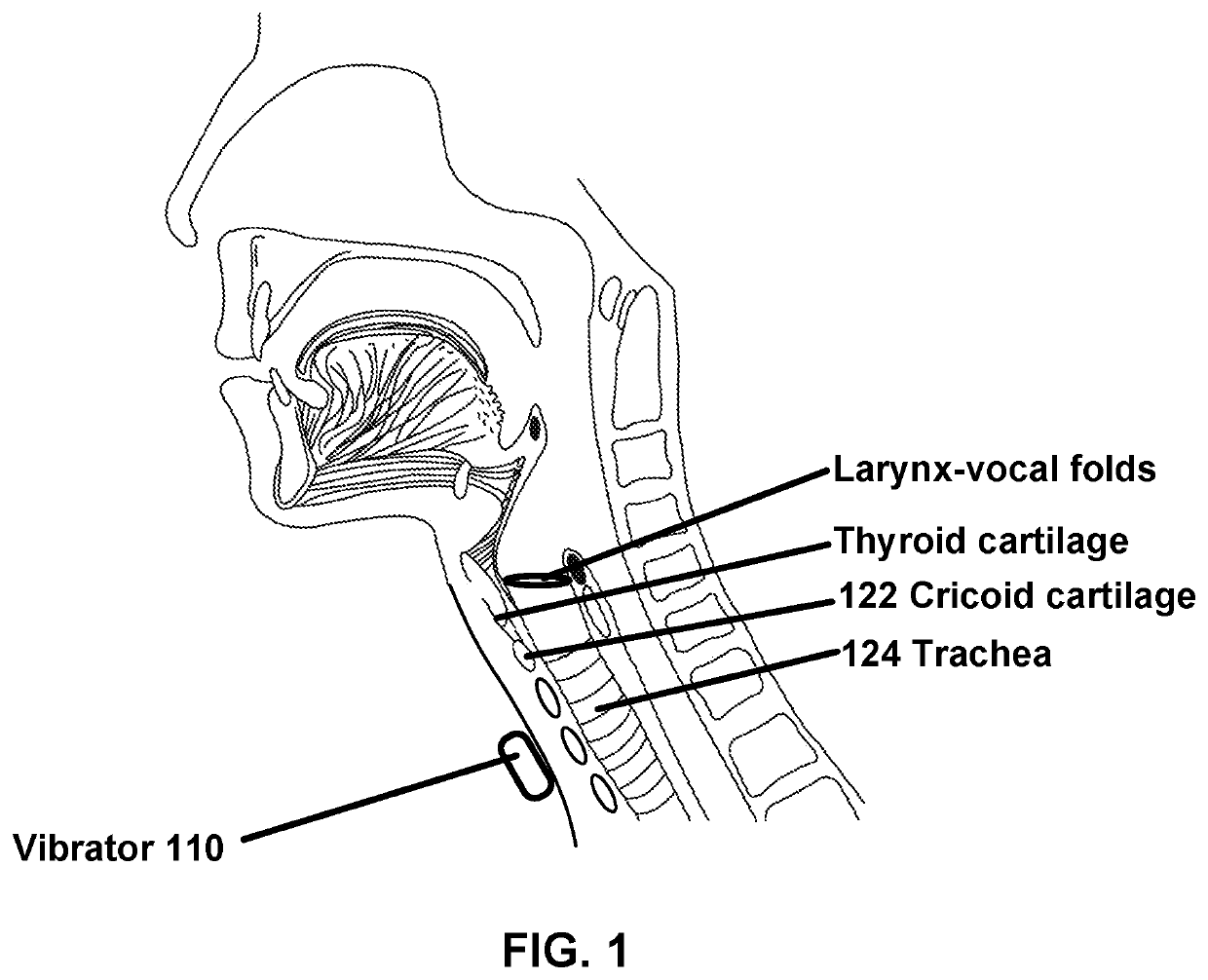 Vibratory Cough Suppression