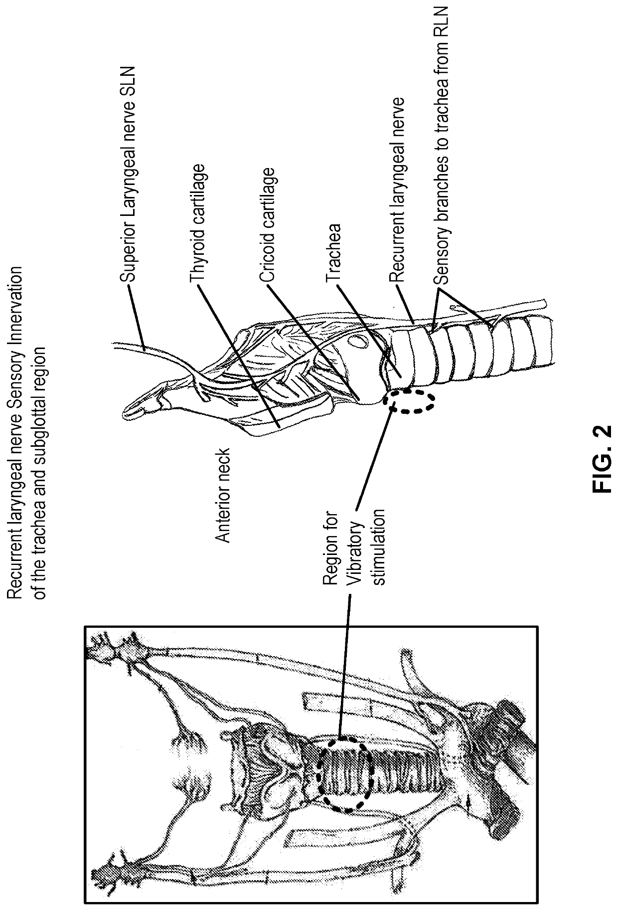 Vibratory Cough Suppression