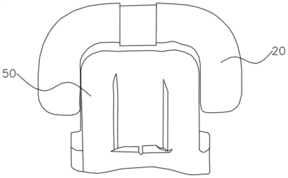 Orthodontic auxiliary bonding guide plate