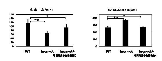 Construction method of zebra fish animal model for cardiovascular disease drug screening