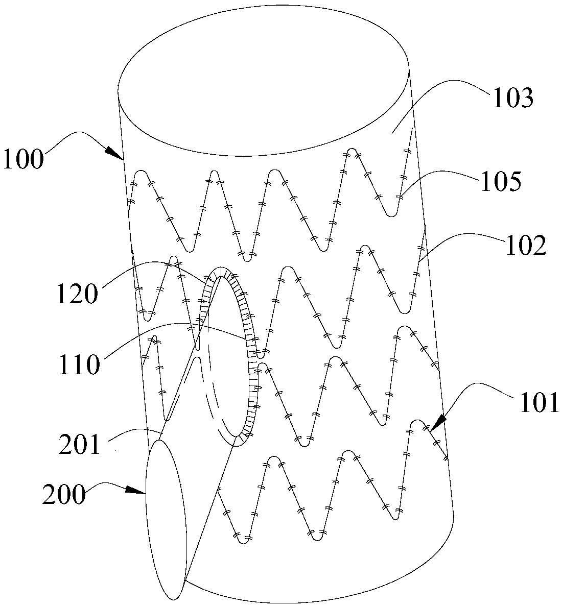 Bifurcated covered stent