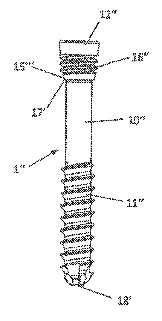 Variable angle bone screw fixation arrangement