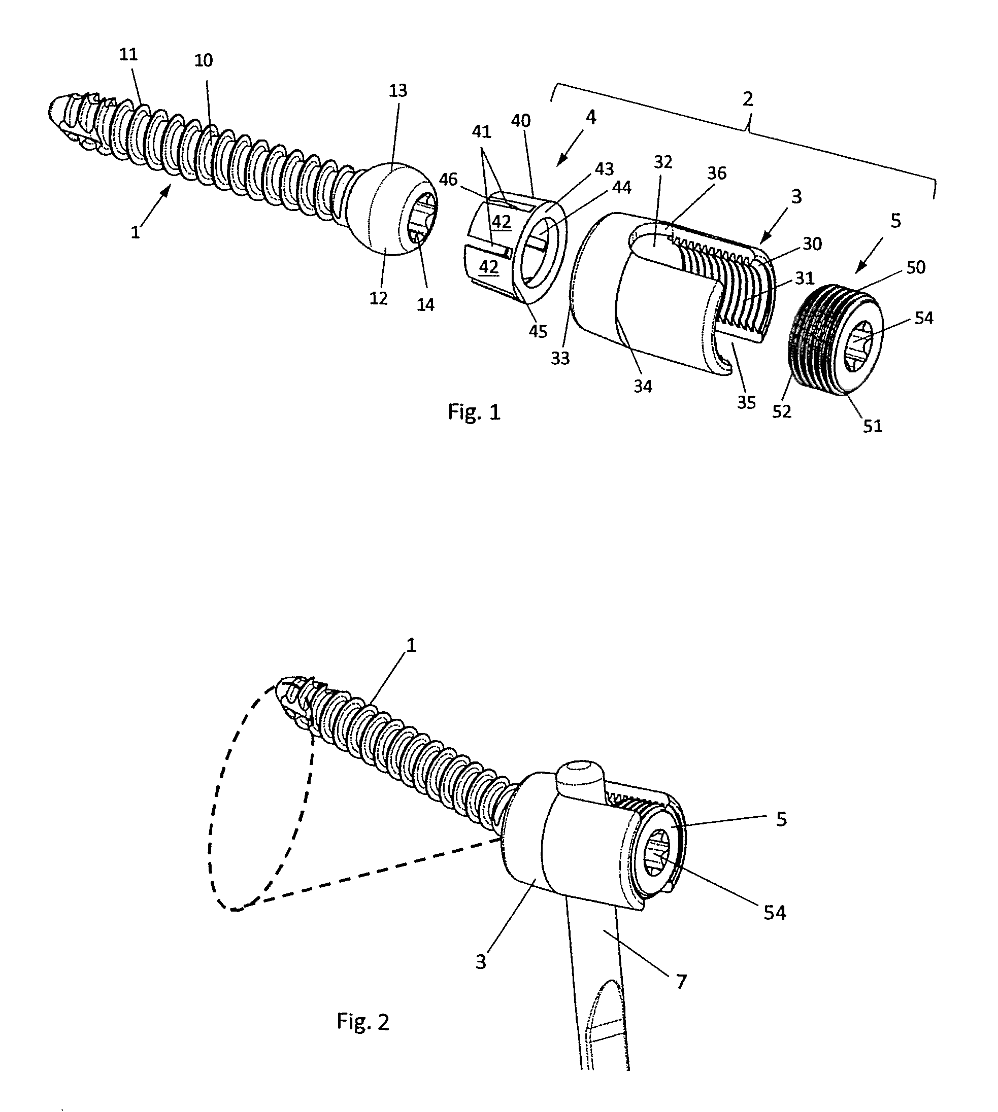 Variable angle bone screw fixation arrangement