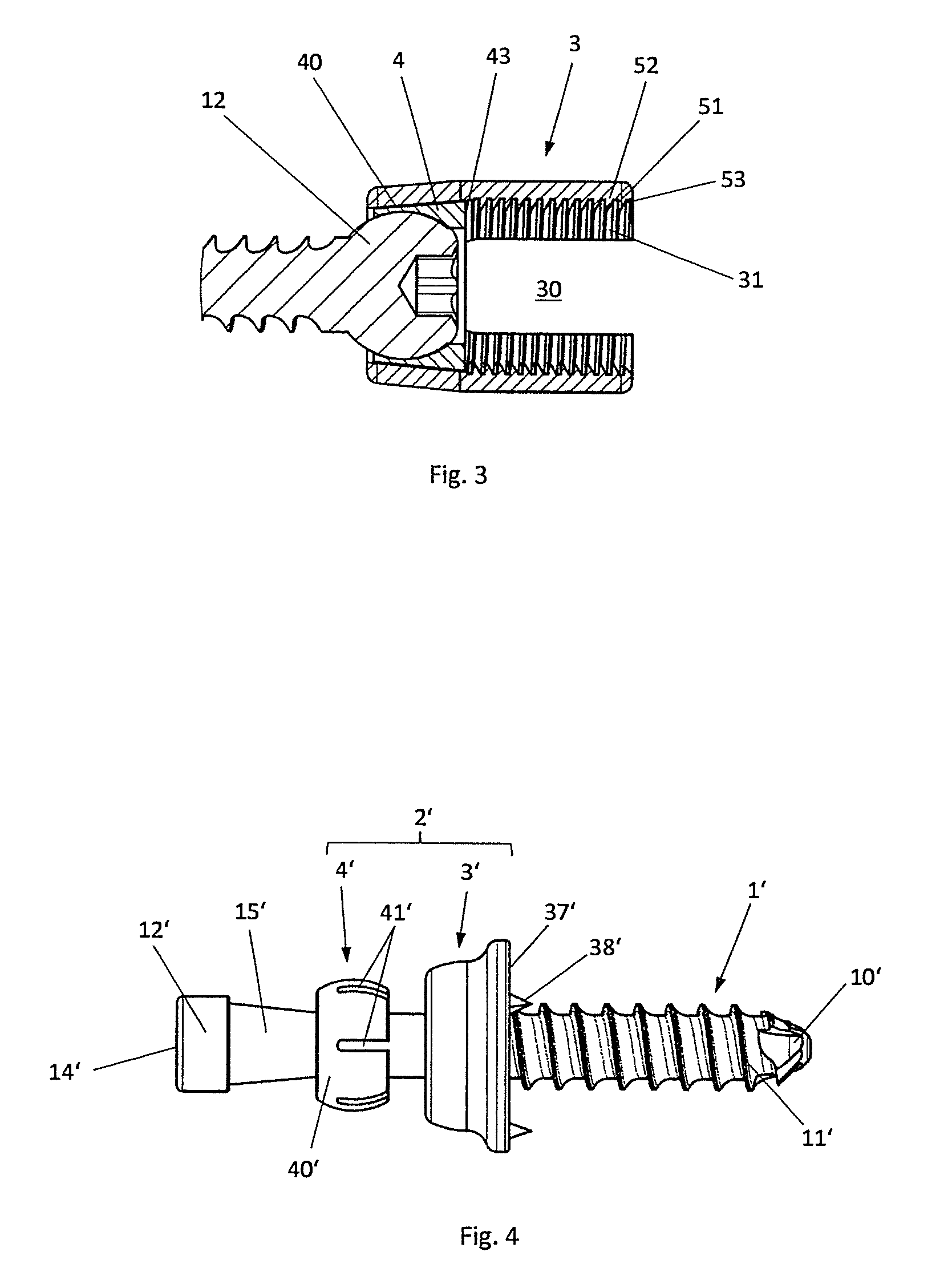 Variable angle bone screw fixation arrangement