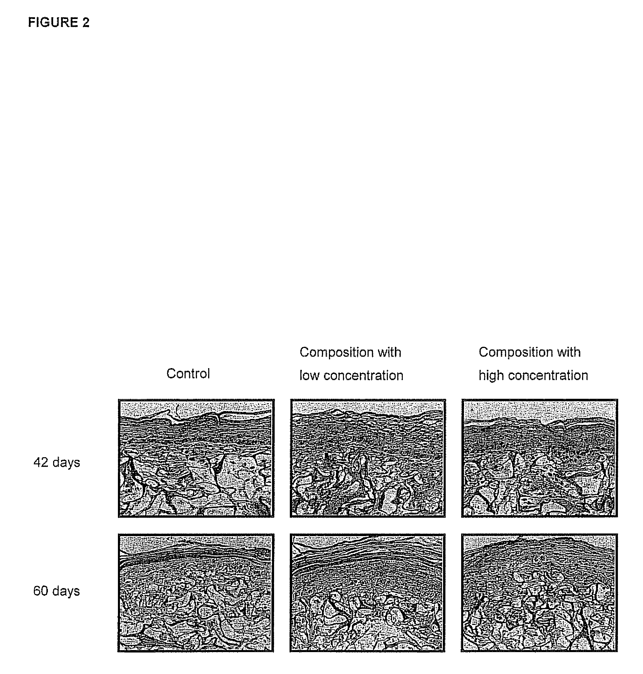 Compositions Suitable For Treating Cutaneous Signs Of Aging