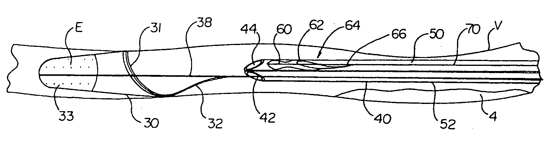 Vascular embolic filter exchange devices and methods of use thereof