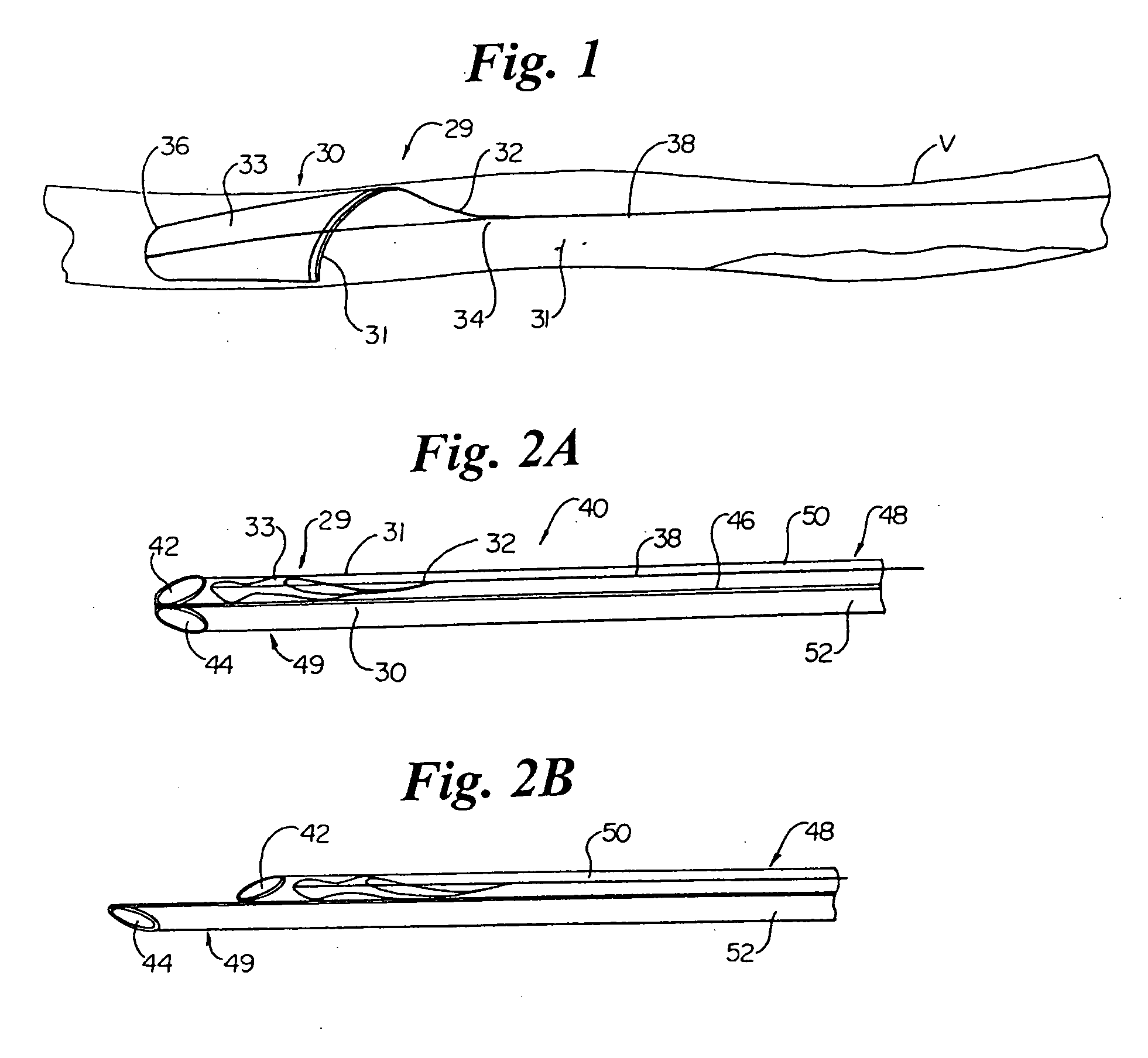 Vascular embolic filter exchange devices and methods of use thereof