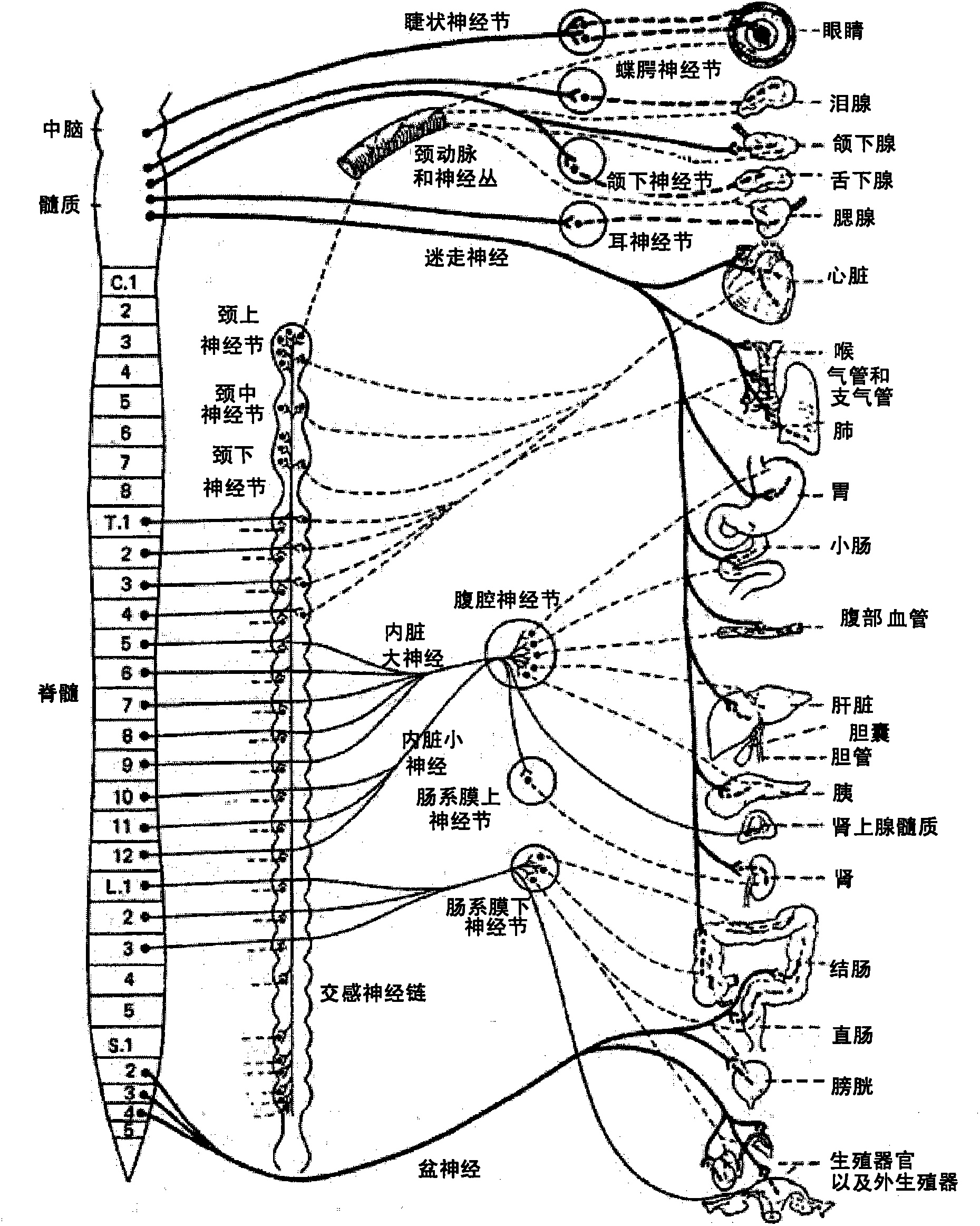 Apparatus, systems and methods for achieving intravascular, thermally-induced renal neuromodulation