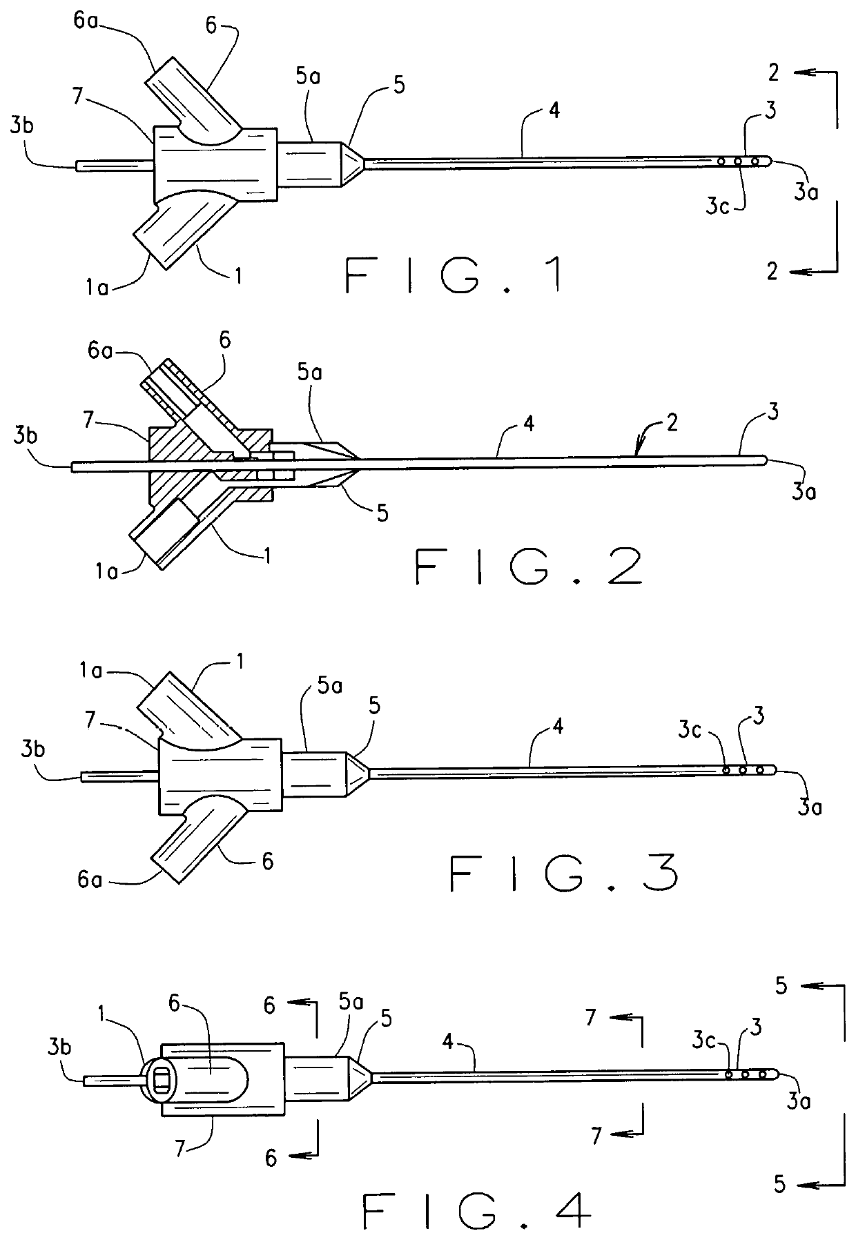 Expandable intra-venous catheter for a faster intra-venous fluid challenge