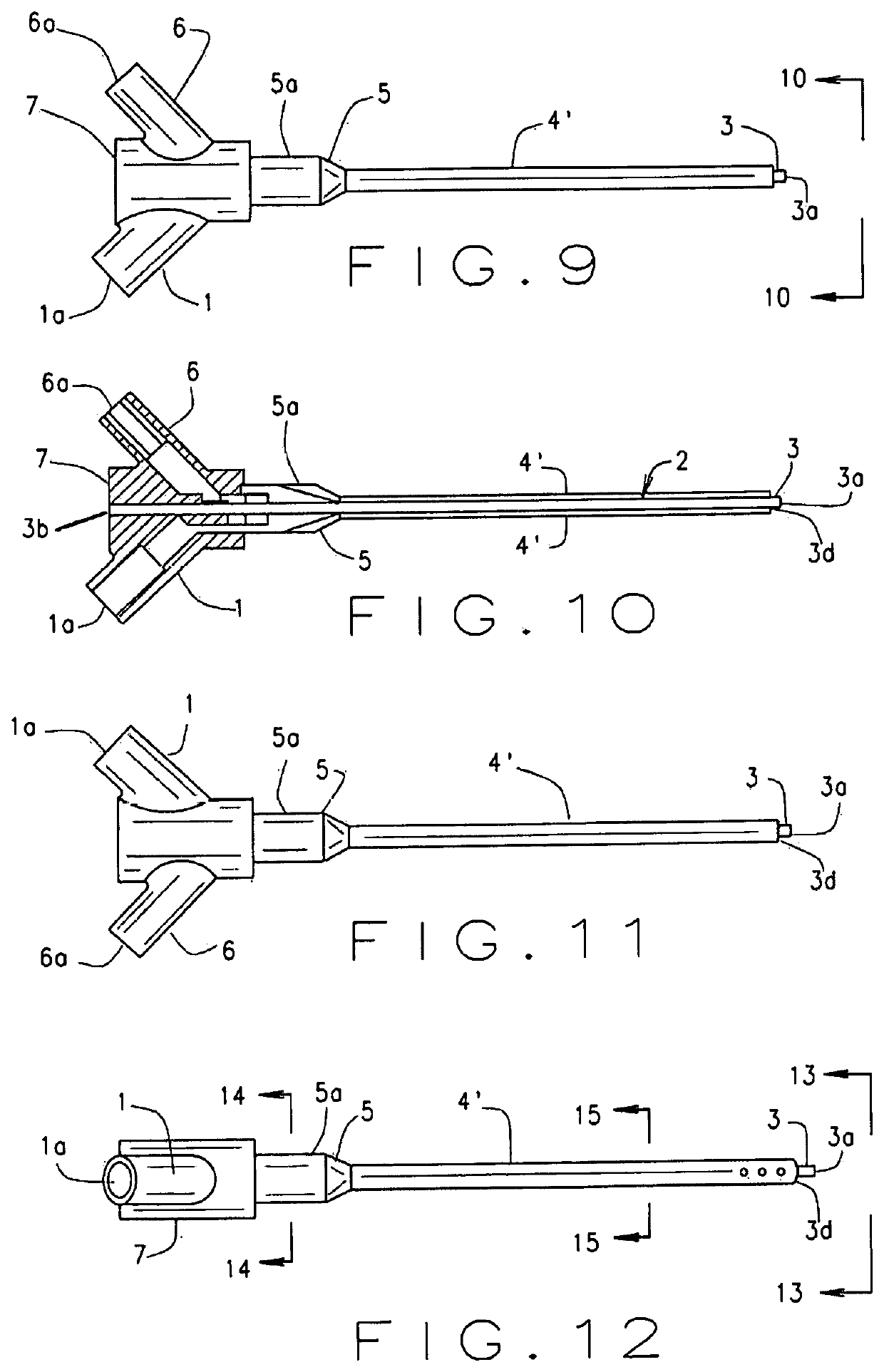 Expandable intra-venous catheter for a faster intra-venous fluid challenge