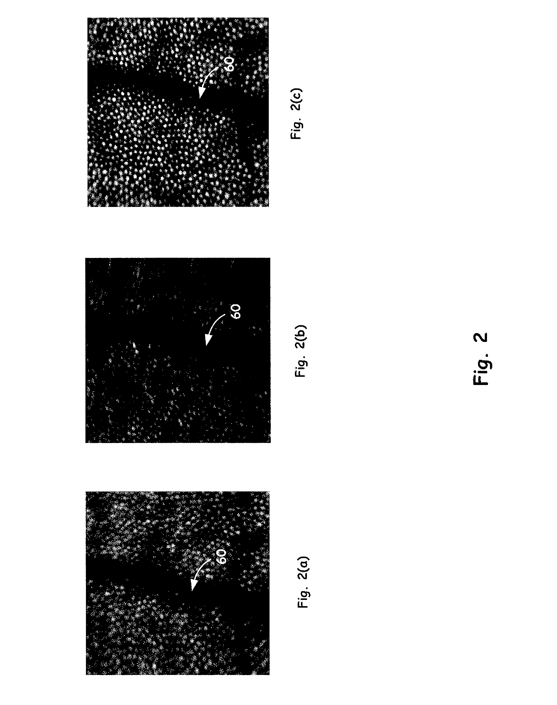 High-resolution adaptive optics scanning laser ophthalmoscope with multiple deformable mirrors