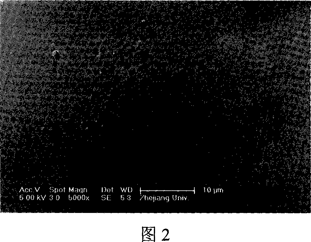 Method for producing compound frame of injection type polyester micro-carrier and fibrin gel