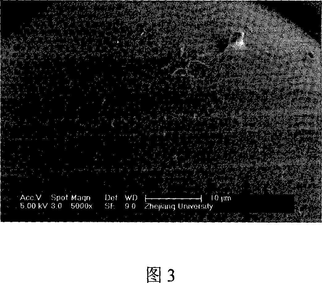 Method for producing compound frame of injection type polyester micro-carrier and fibrin gel