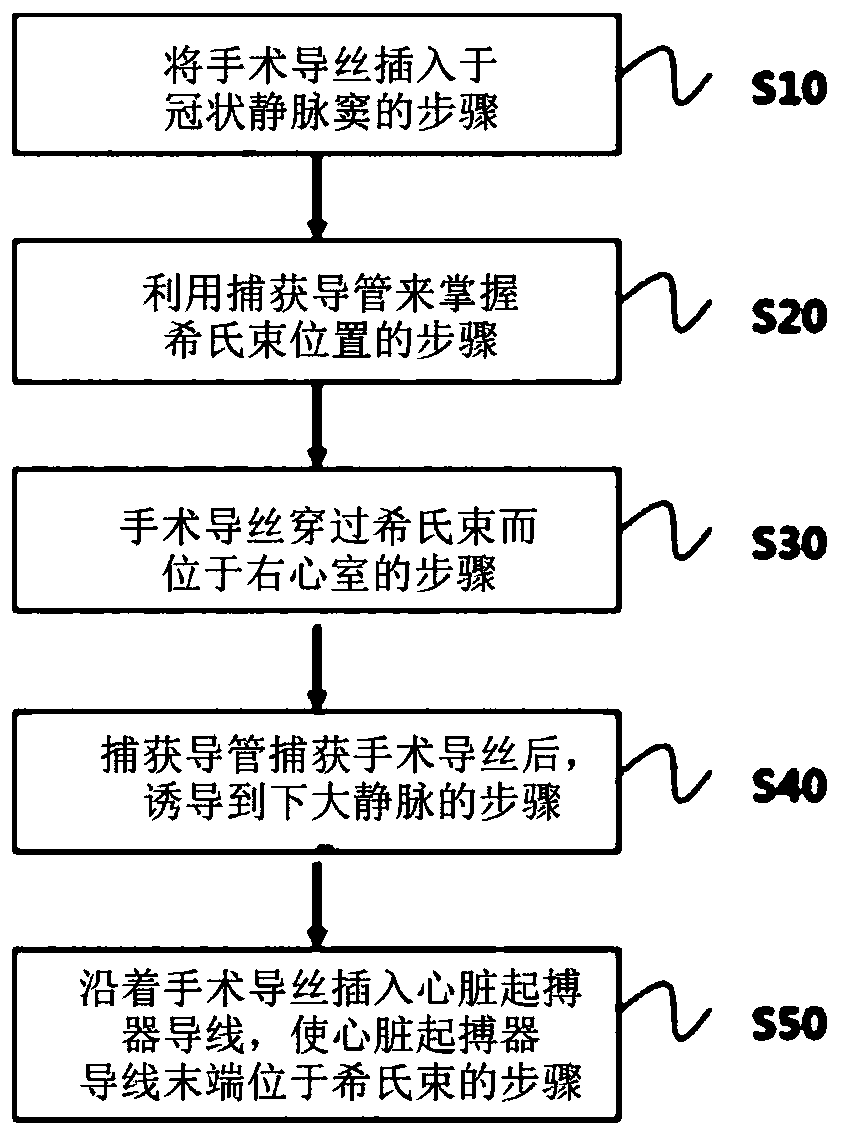 Device for placing, in his bundle, pacemaker lead tip having passed through coronary sinus