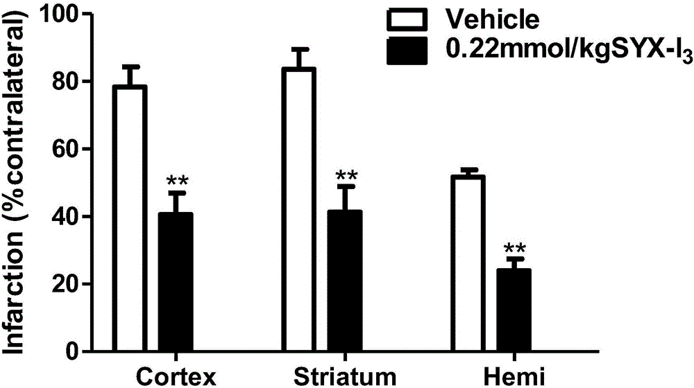 Ferulic acid derivatives, preparation and application of ferulic acid derivatives