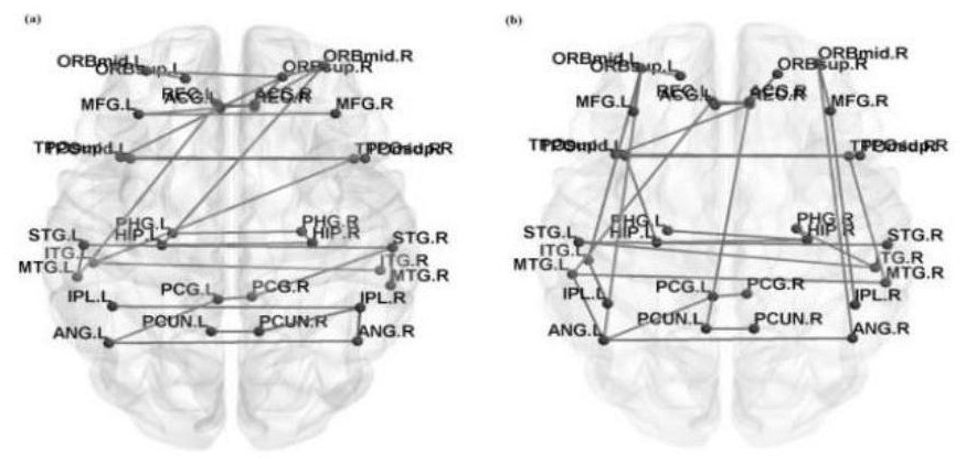 Brain network classification method combining node attributes and multi-level topology