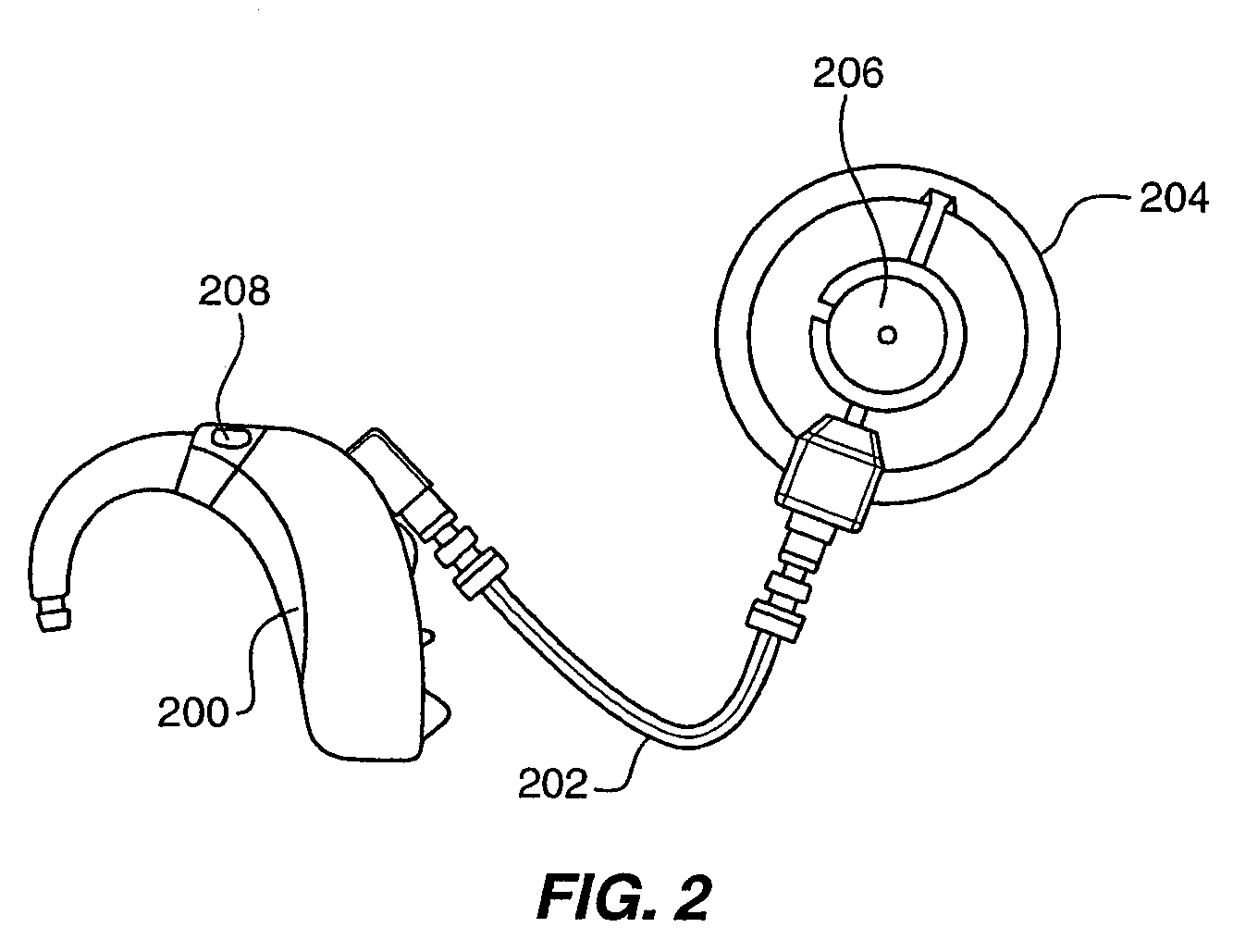 Method and system for external assessment of hearing aids that include implanted actuators