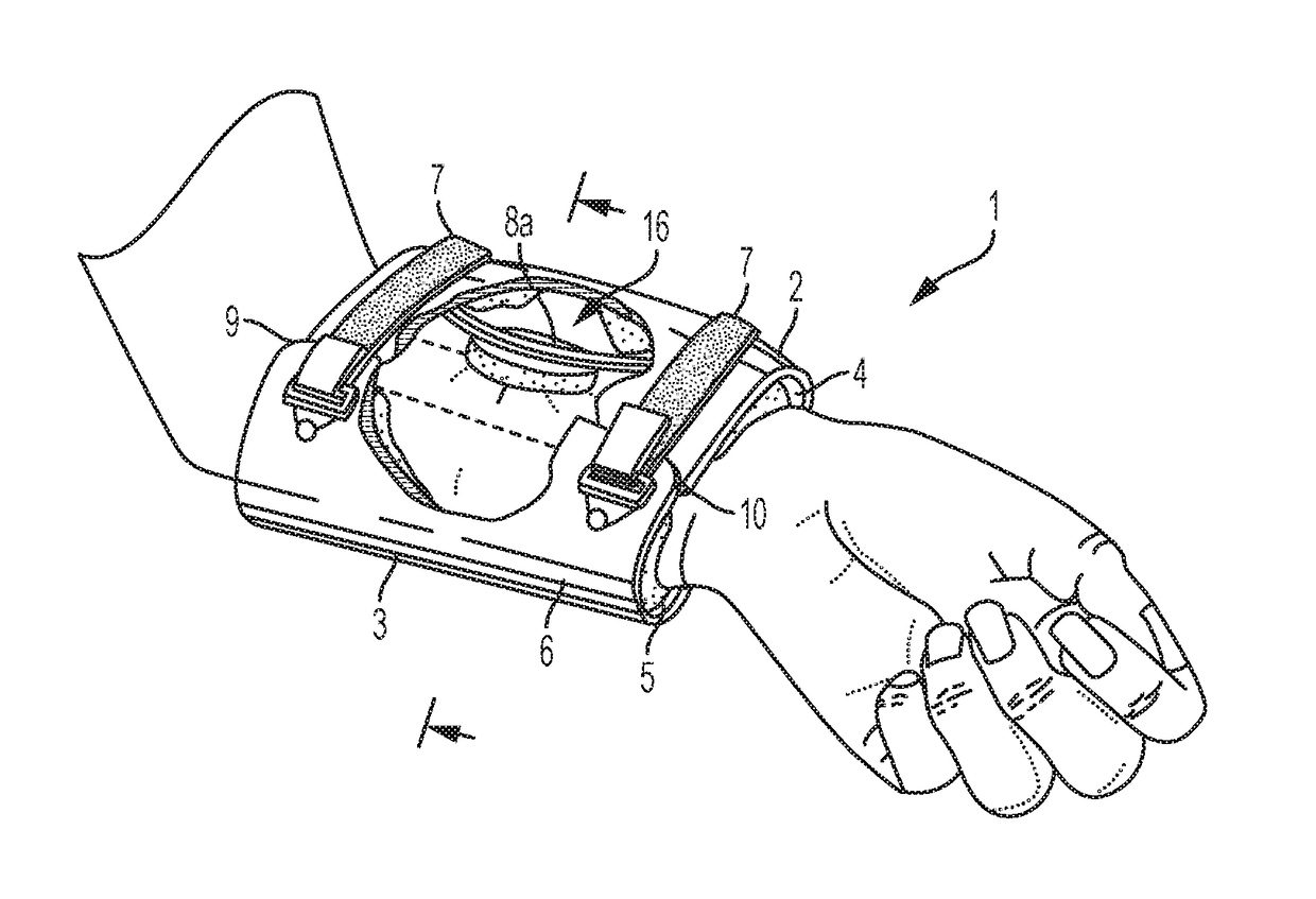 Orthopaedic device and method of use for treating bone fractures