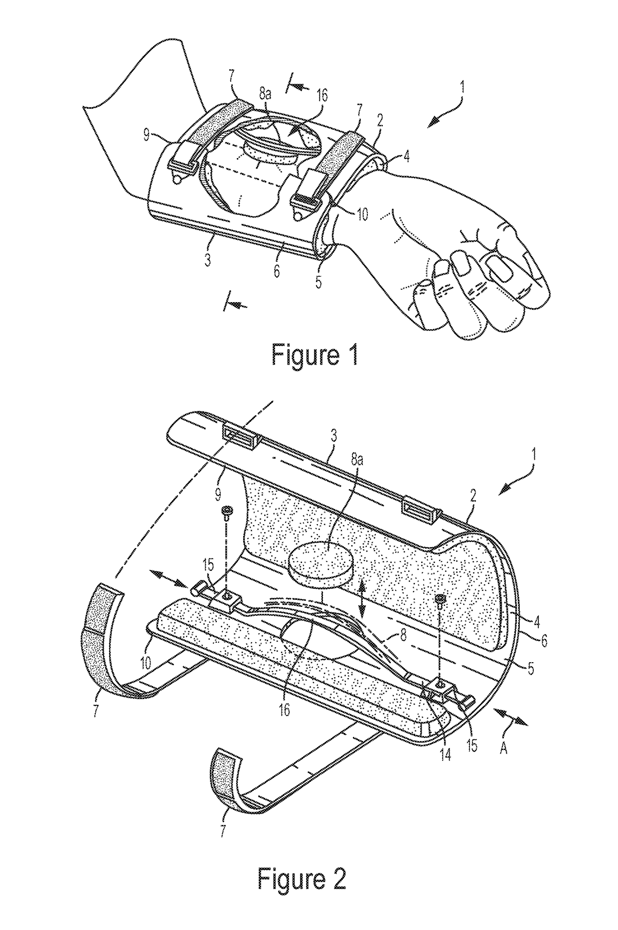 Orthopaedic device and method of use for treating bone fractures