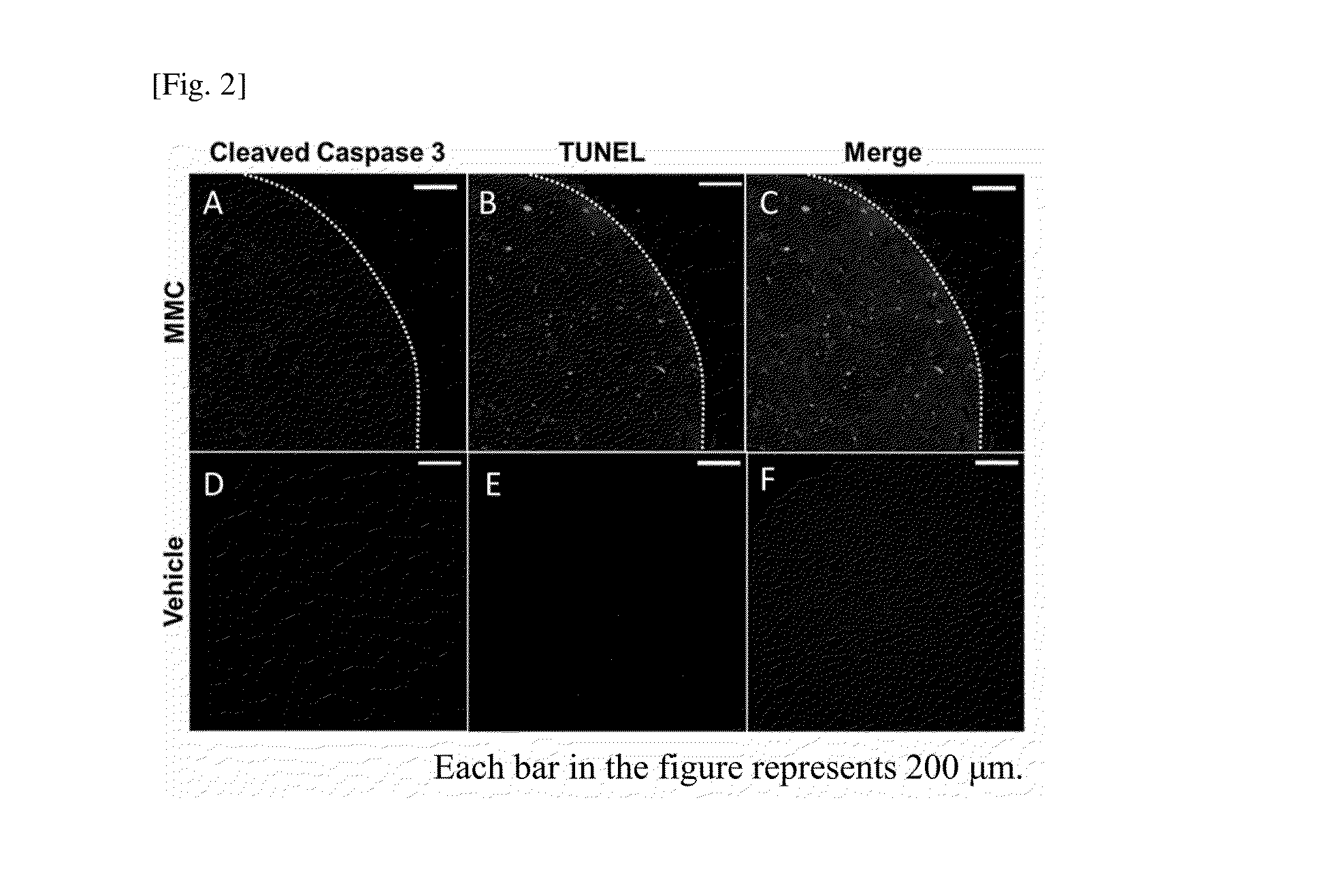 Probe for detecting dead cell