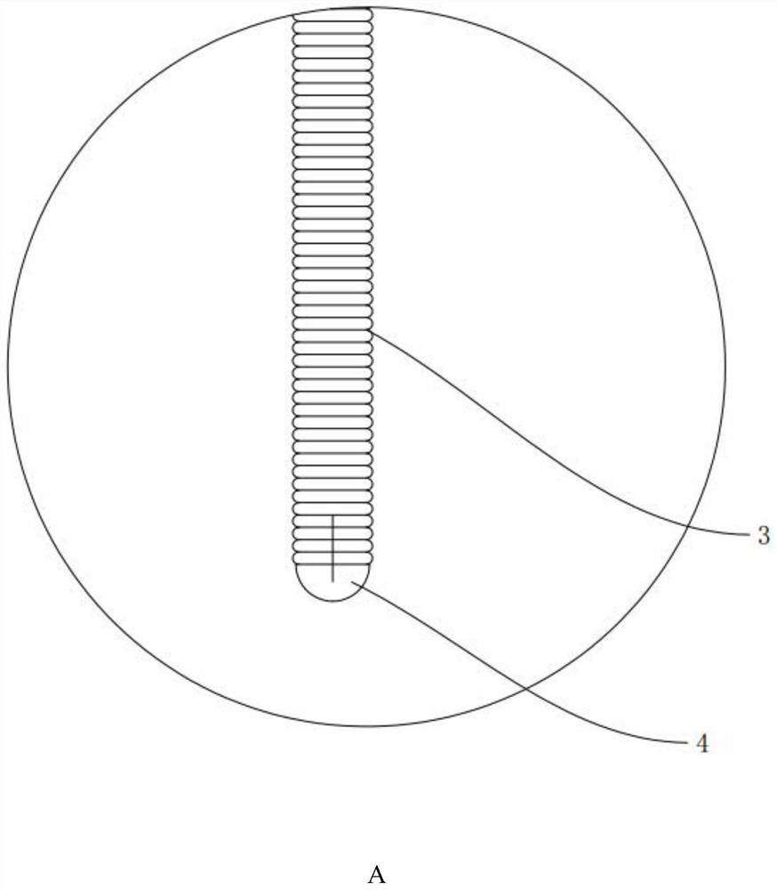 Peripheral thrombectomy mesh basket