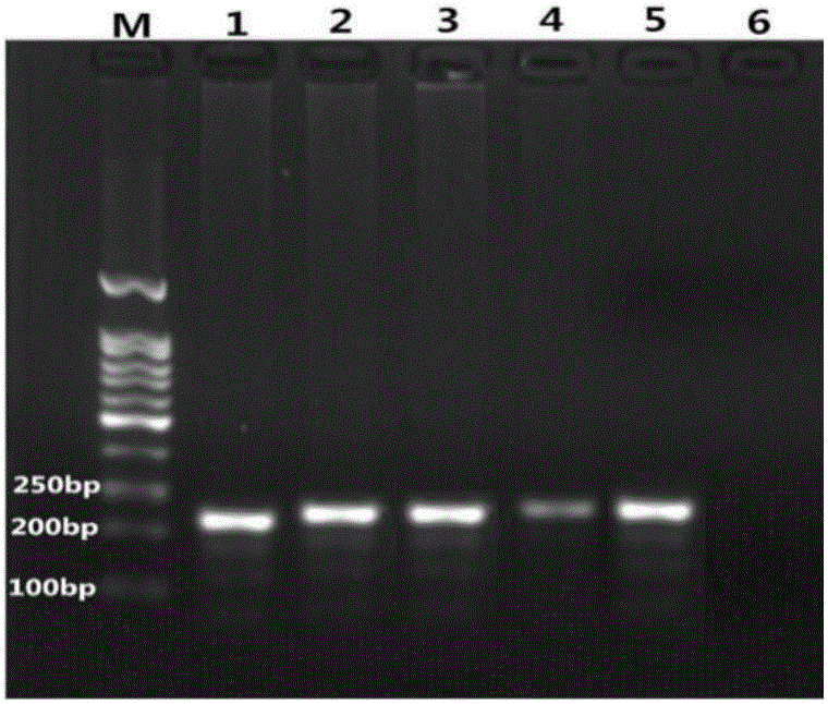 Kit for detecting enterocytozoonhepatopenaei