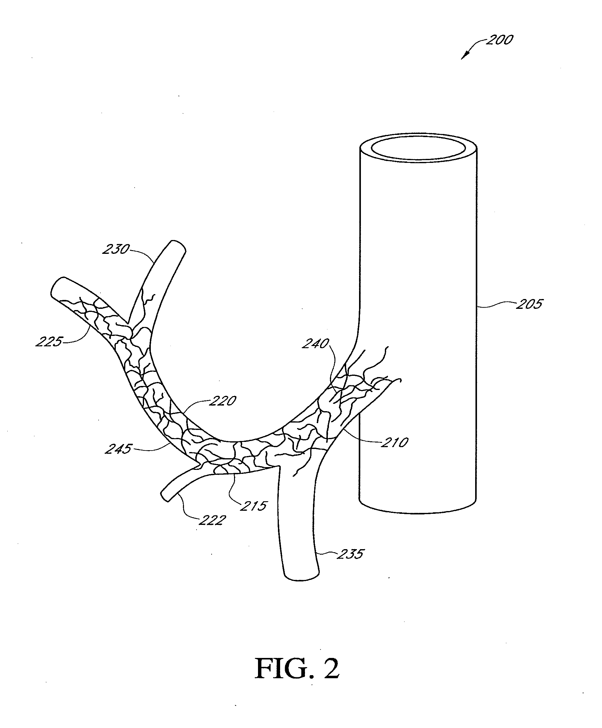 Hepatic neuromodulation using microwave energy