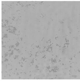 A kind of high-efficiency erosion bacterium Serratia liquefaction nlx-15 of silicate rock and its application