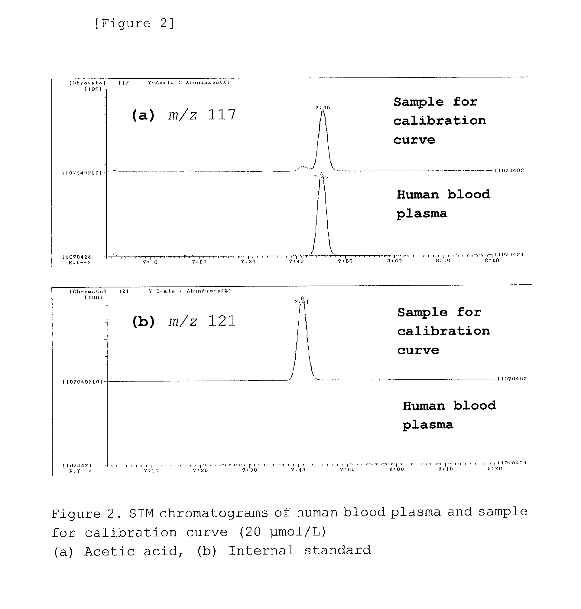 Method for measuring acetic acid concentration in blood plasma