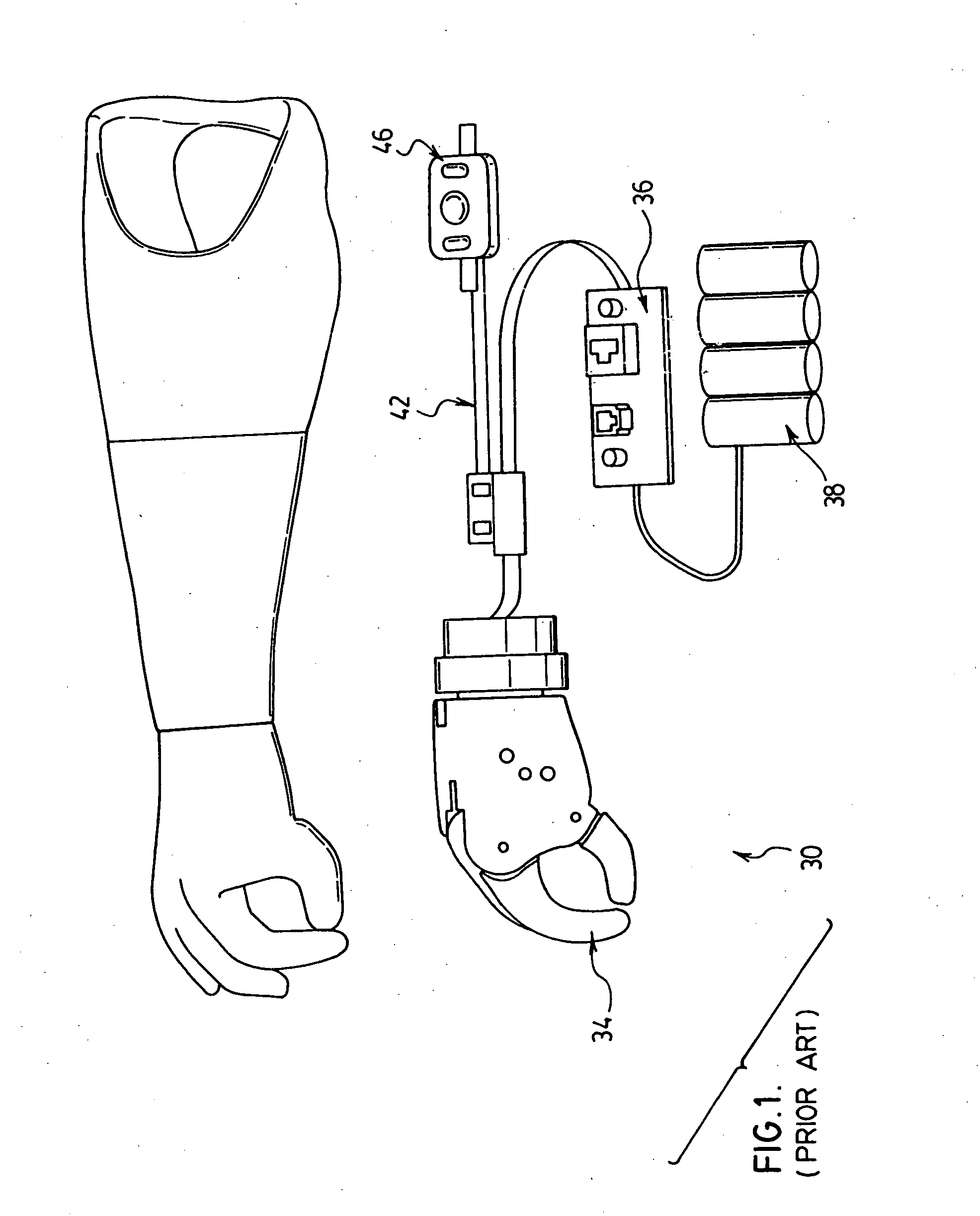 Electromyographic sensor