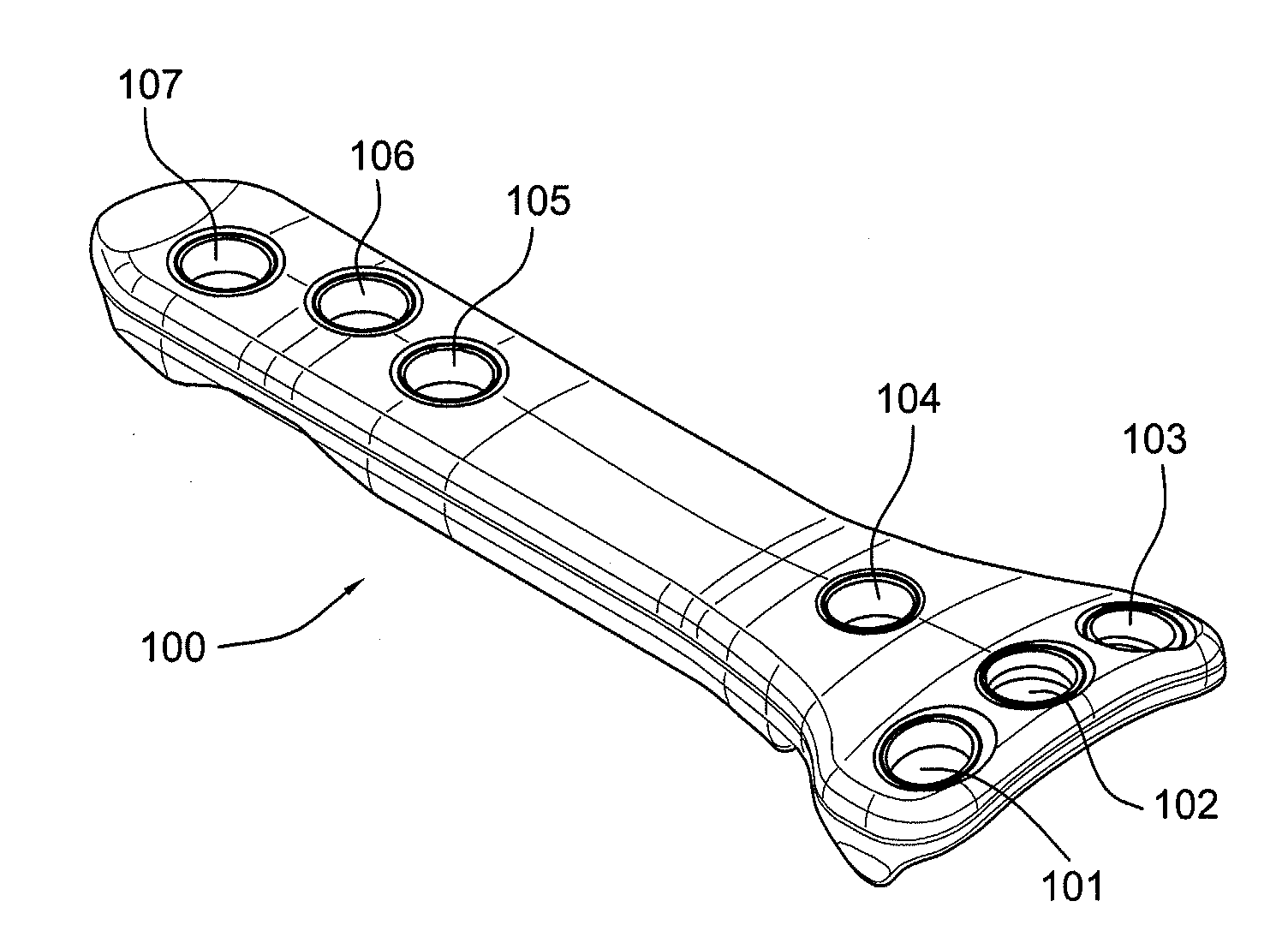 Carbon Fiber Reinforced Peek Bone Plate With Titanium Fixation Screws