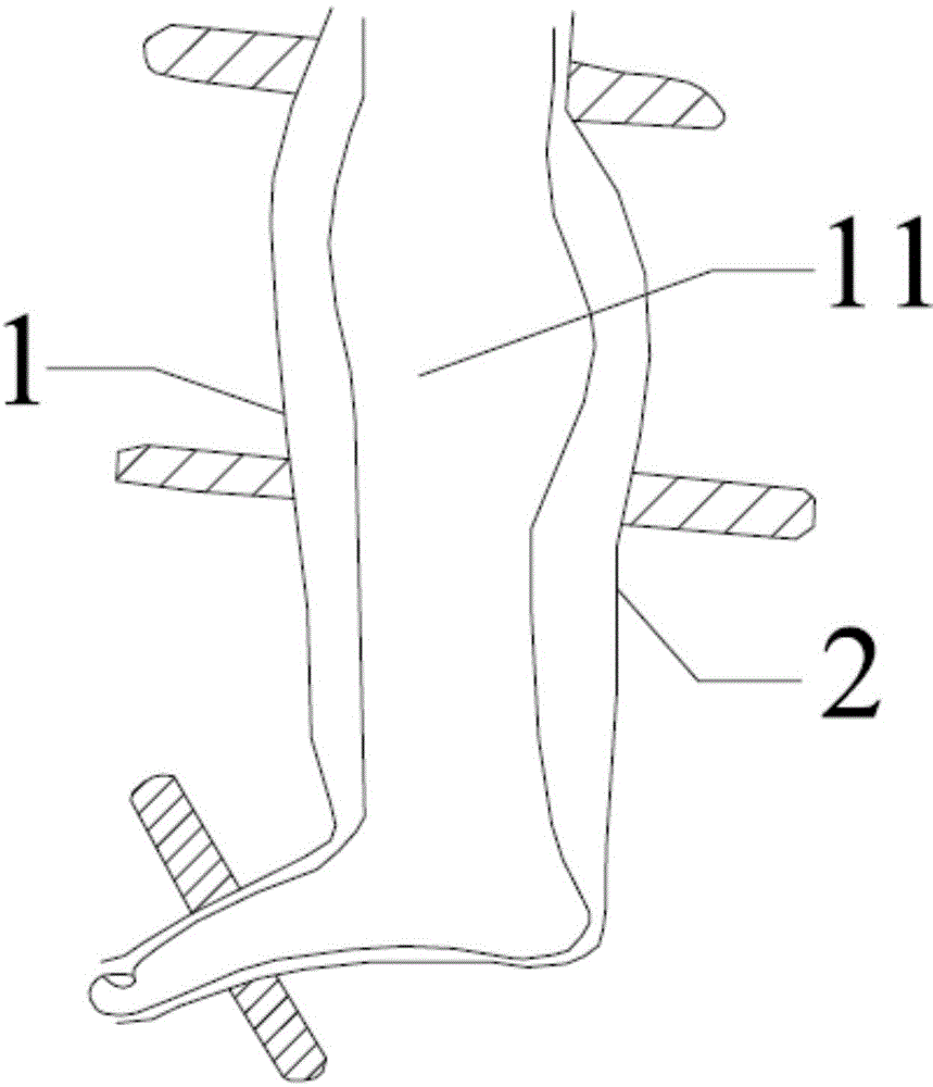 Flap postoperative protection device for lower middle segment of shank