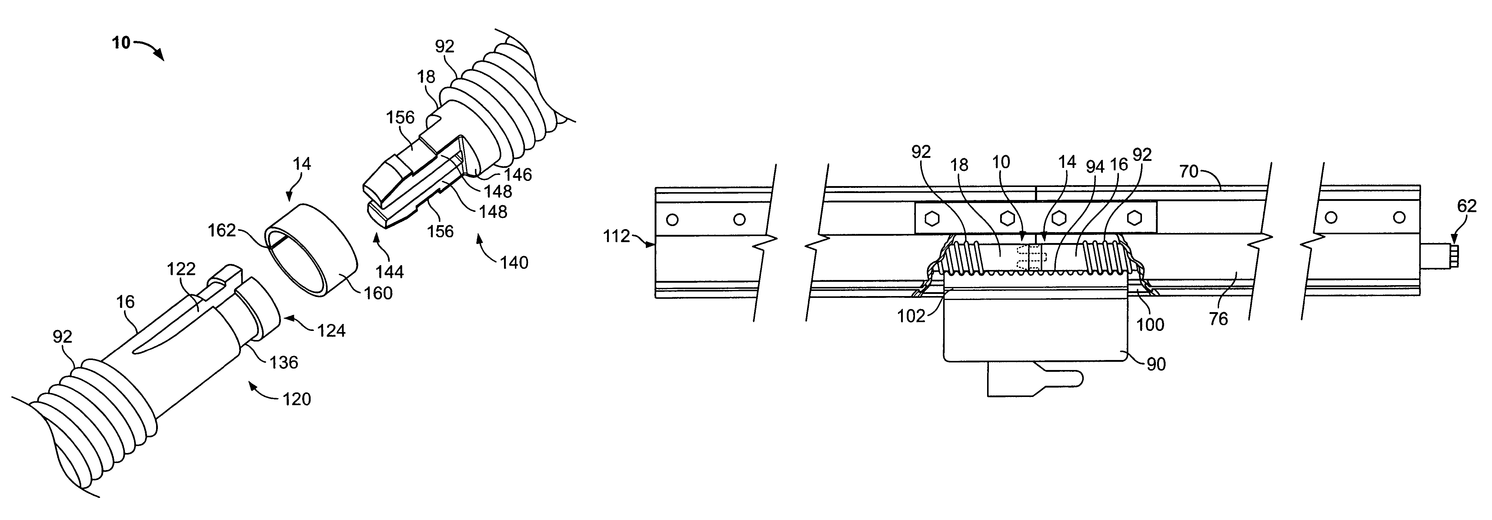 Shaft joint