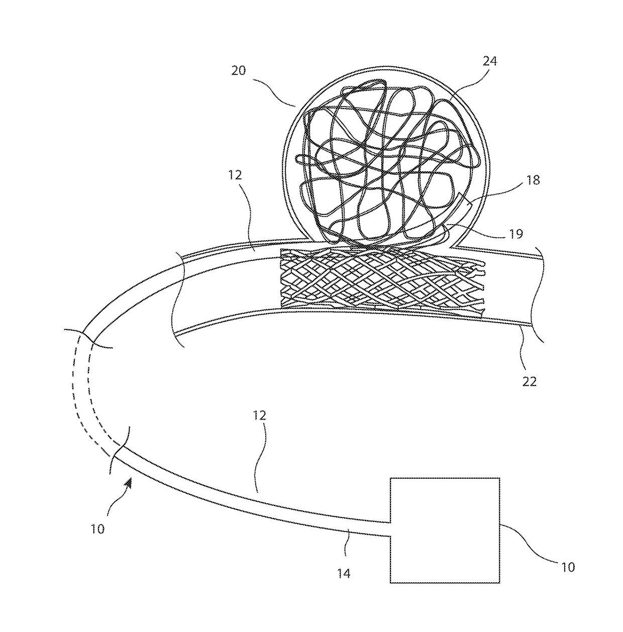 Apparatus for delivering filamentary material into a patient