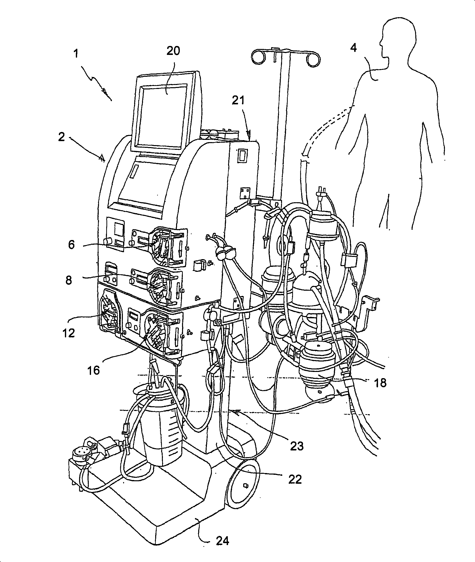 System for monitoring extracorporeal circulation and perfusion of medical fluid in heart lung bypass process