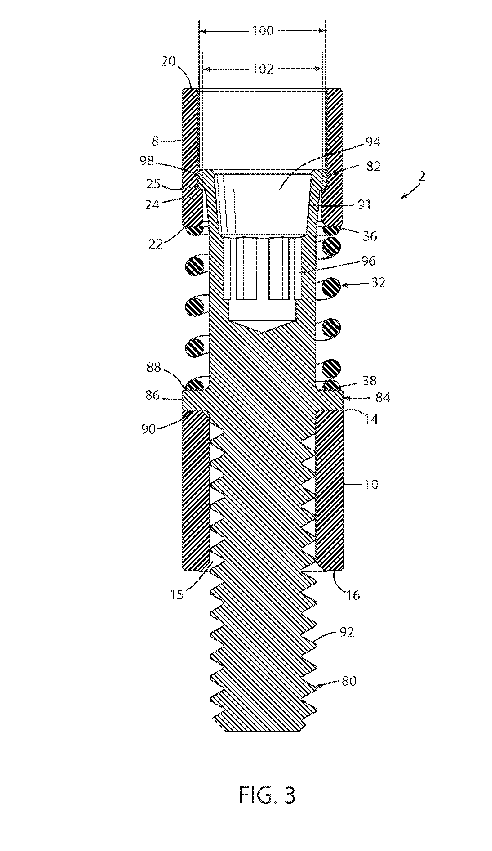 Stock ejector assembly