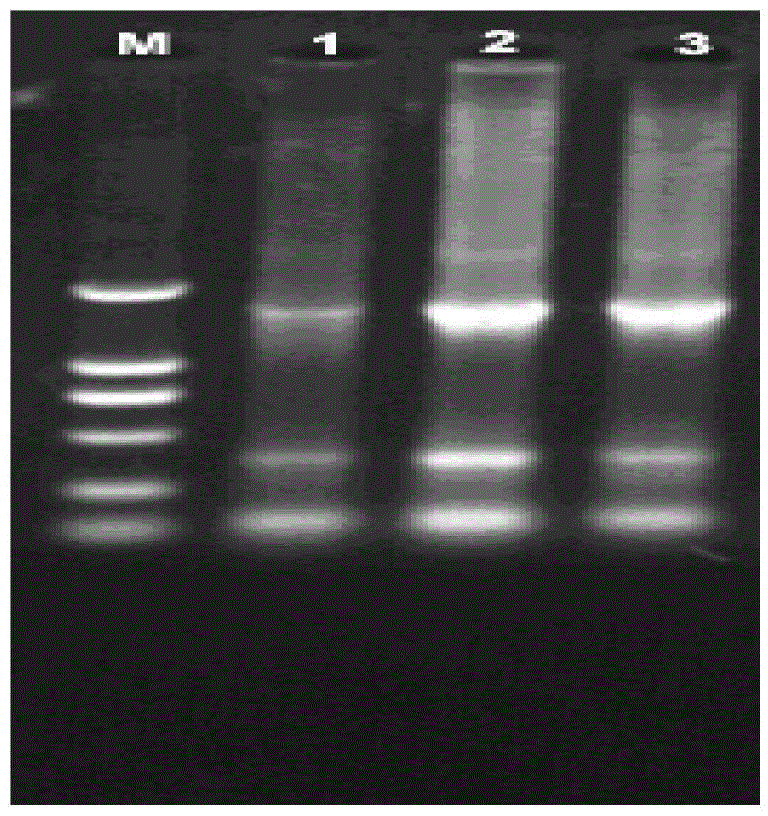 Method for analyzing influences of E2F3 gene slicing on whole blood E2F3 in prostate cancer animal model