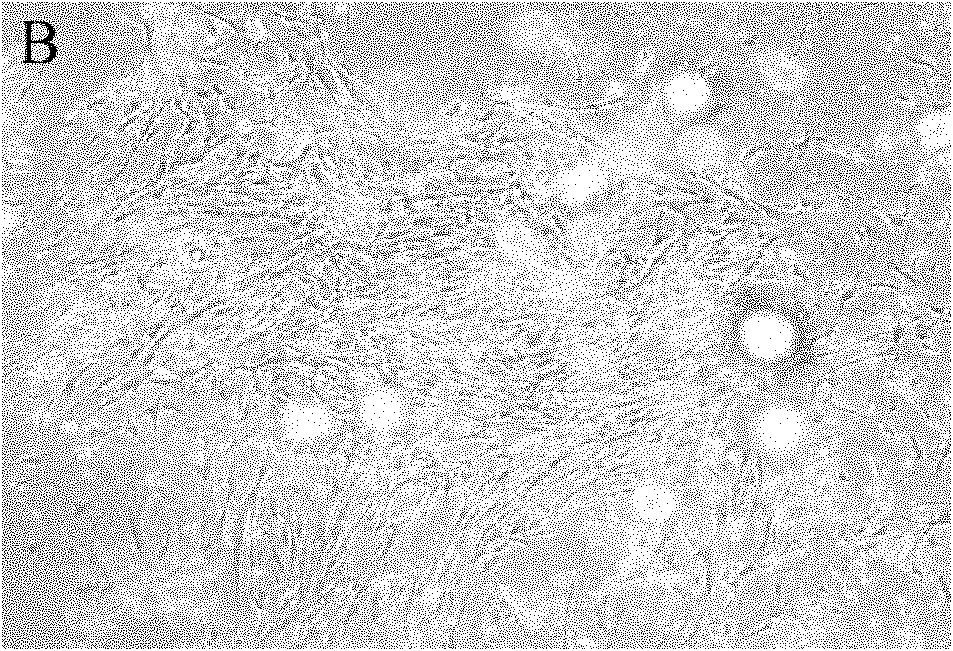 Adipose-derived stem cell separation culture method