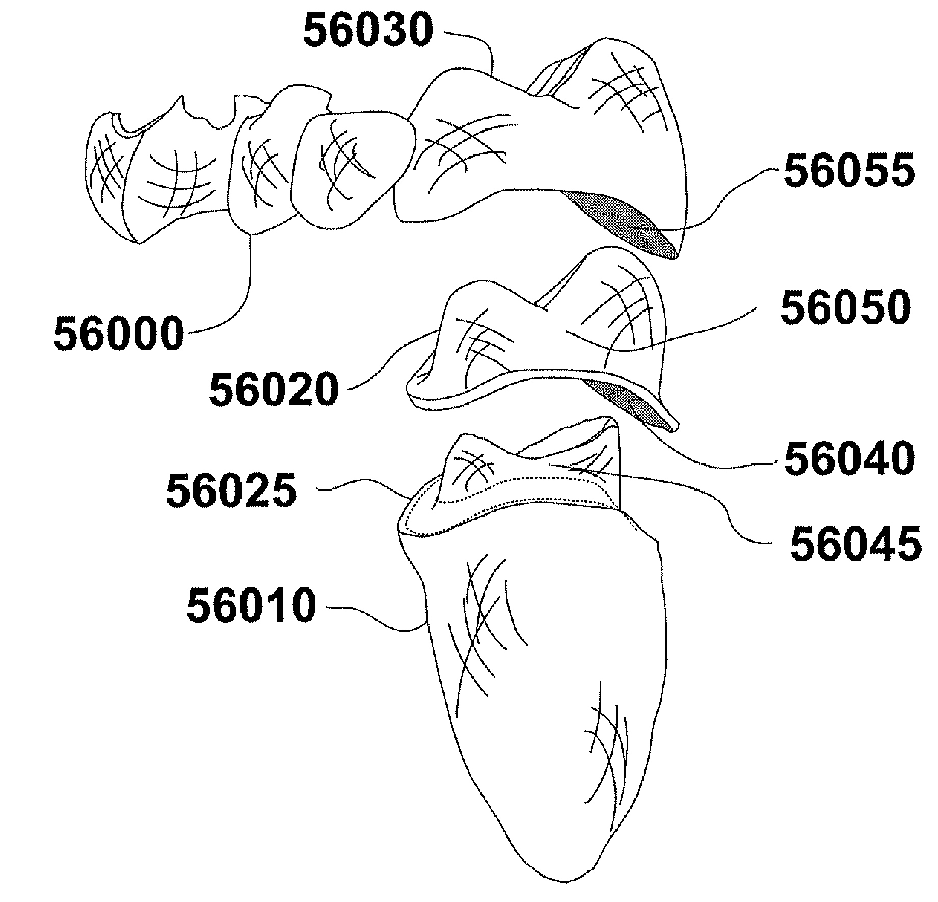 Methods of designing and manufacturing customized dental prosthesis for periodontal or osseointegration and related systems