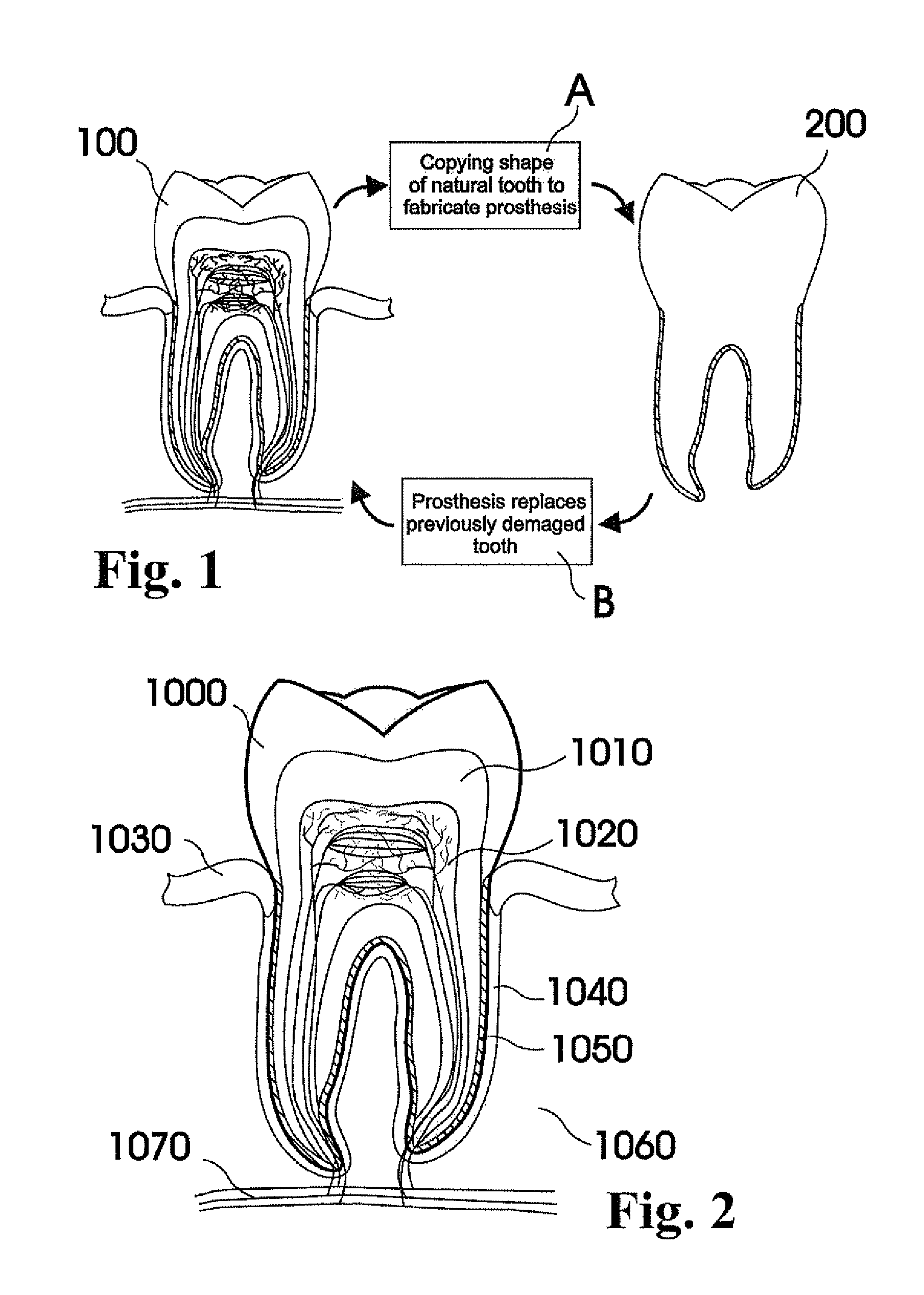 Methods of designing and manufacturing customized dental prosthesis for periodontal or osseointegration and related systems