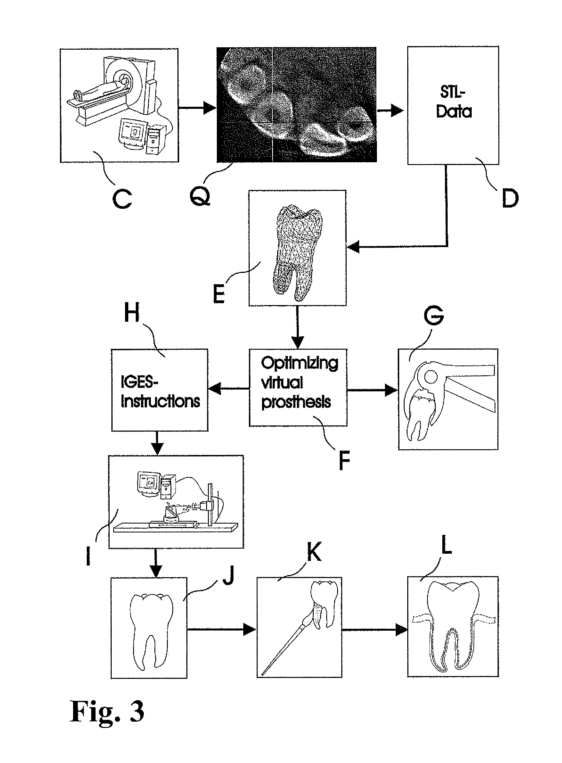 Methods of designing and manufacturing customized dental prosthesis for periodontal or osseointegration and related systems