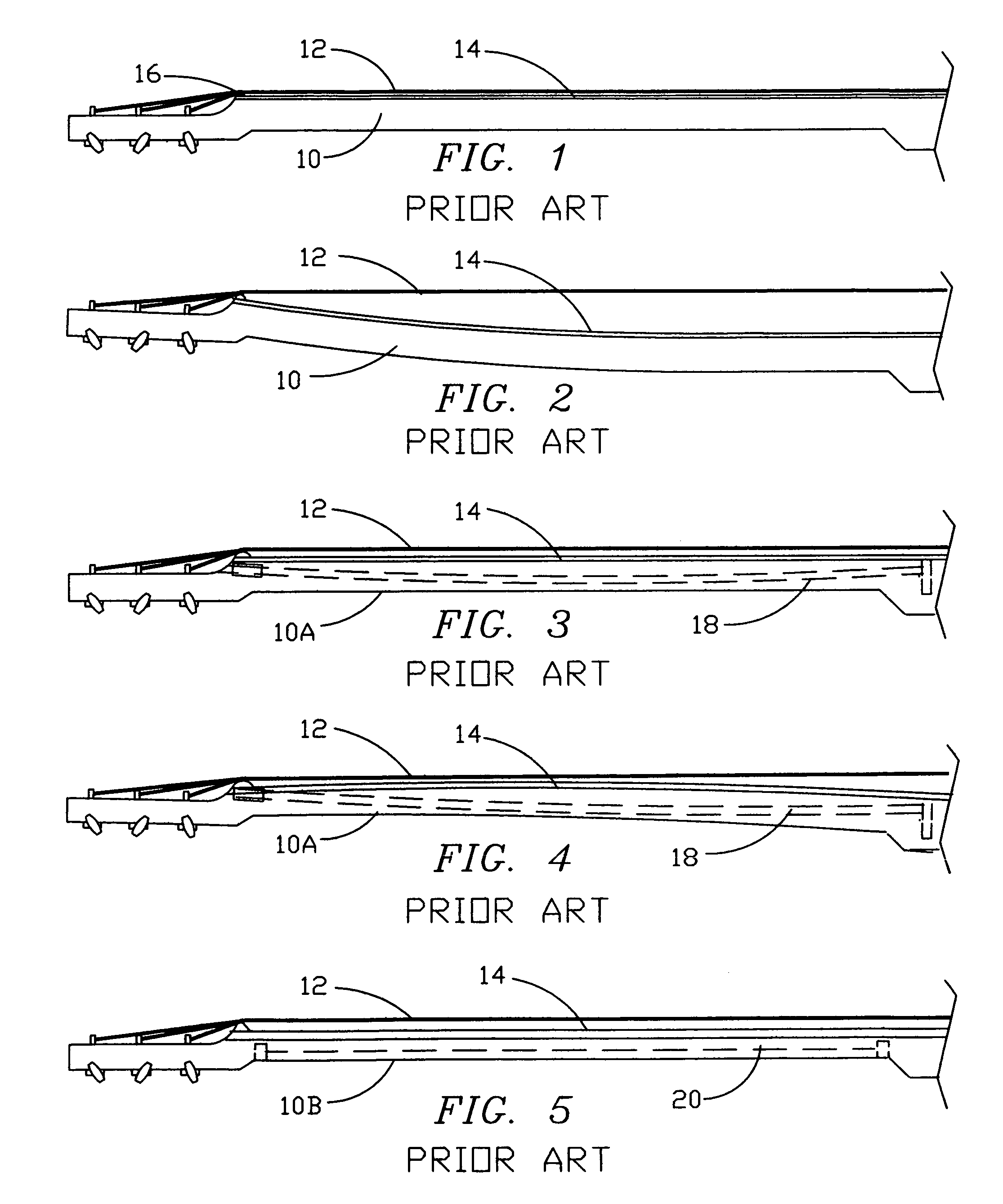 Versatile neck truss system for stringed musical instruments