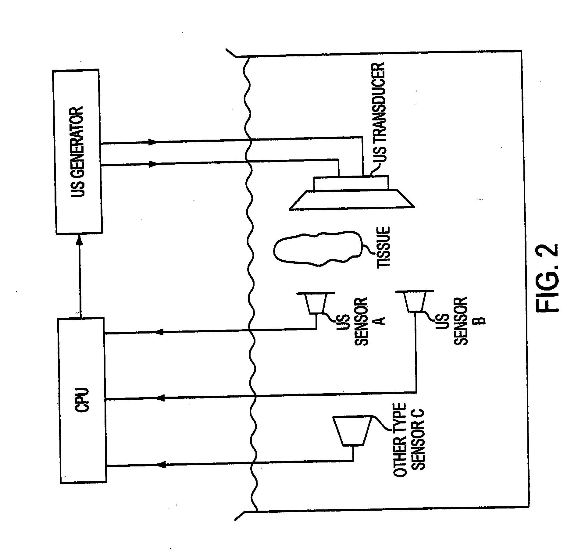 Ultrasound-mediated high-speed biological reaction and tissue processing