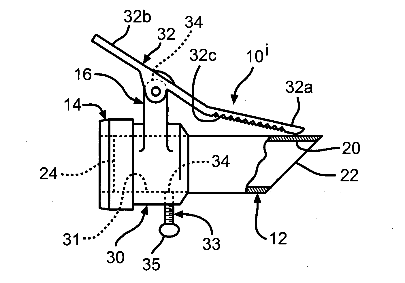 Variable size trocar