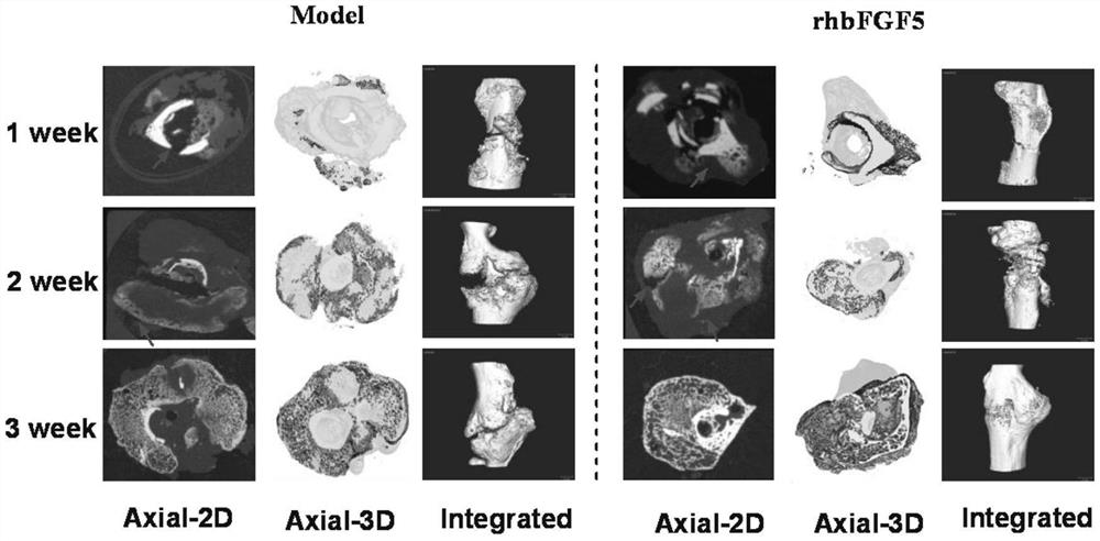 Application of Recombinant Human Fibroblast Growth Factor-5 in Promoting Fracture Healing