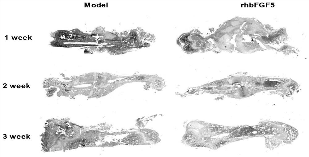 Application of Recombinant Human Fibroblast Growth Factor-5 in Promoting Fracture Healing